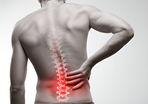 back-pain